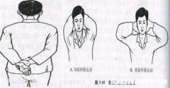 肩周炎怎么治疗好 肩周炎怎么治疗好得较快