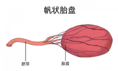 怀孕多久会长胎盘 怀孕胎盘低有什么影响