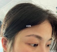 纹眉后不掉伽好不好 纹眉之后不掉痂怎么办