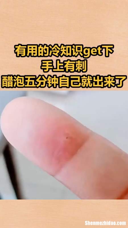 梦到手上有刺又拔刺 梦见手上拔刺