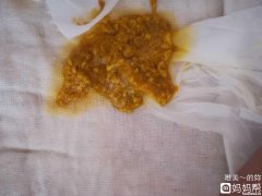 宝宝总是吐奶瓣怎么办 宝宝总是吐奶瓣怎么办啊