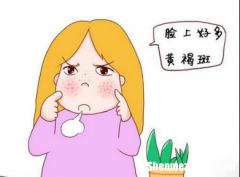 黄褐斑是怎么引起的 黄褐斑是怎么引起的怎么调理能治好