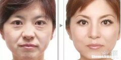 保湿除皱 保湿除皱眼霜排行榜
