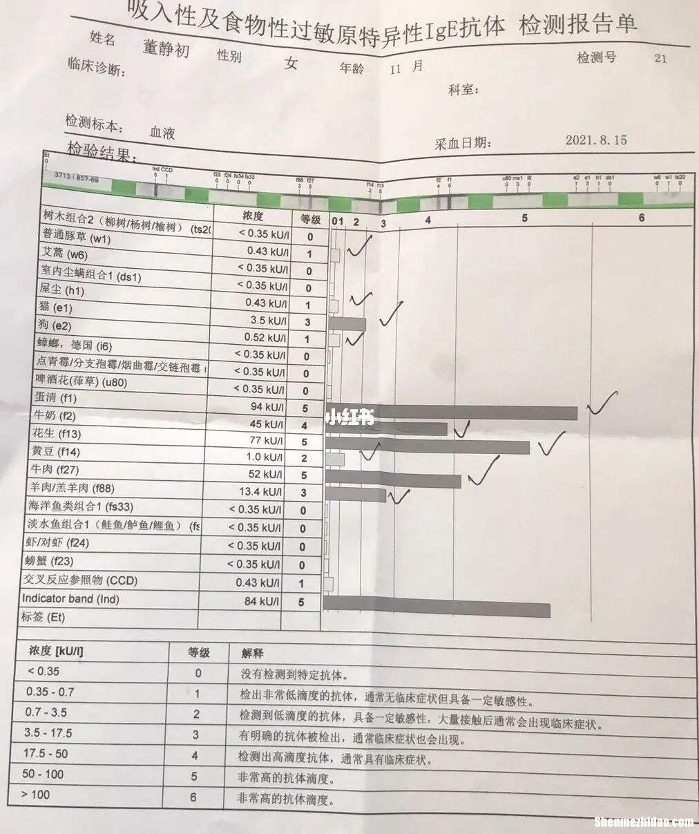 测过敏源结果要多久 测试过敏源要多久出结果