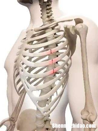 肋骨骨折怎么办 第三根肋骨骨折怎么办