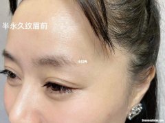 洗眉提眉纹眉好不好 洗眉多久可以做提眉手术