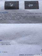 8个月引产多久能来月经 八个月引产以后还会怀孕吗
