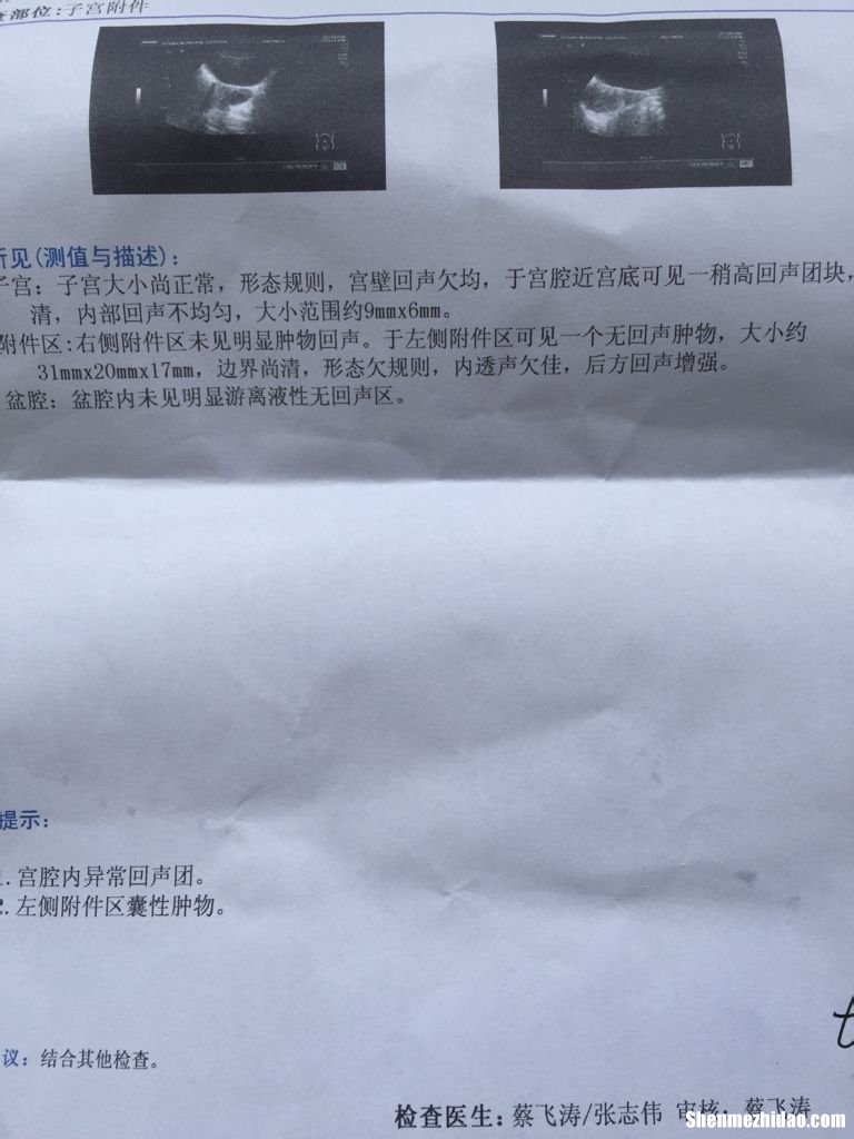 8个月引产多久能来月经 八个月引产以后还会怀孕吗
