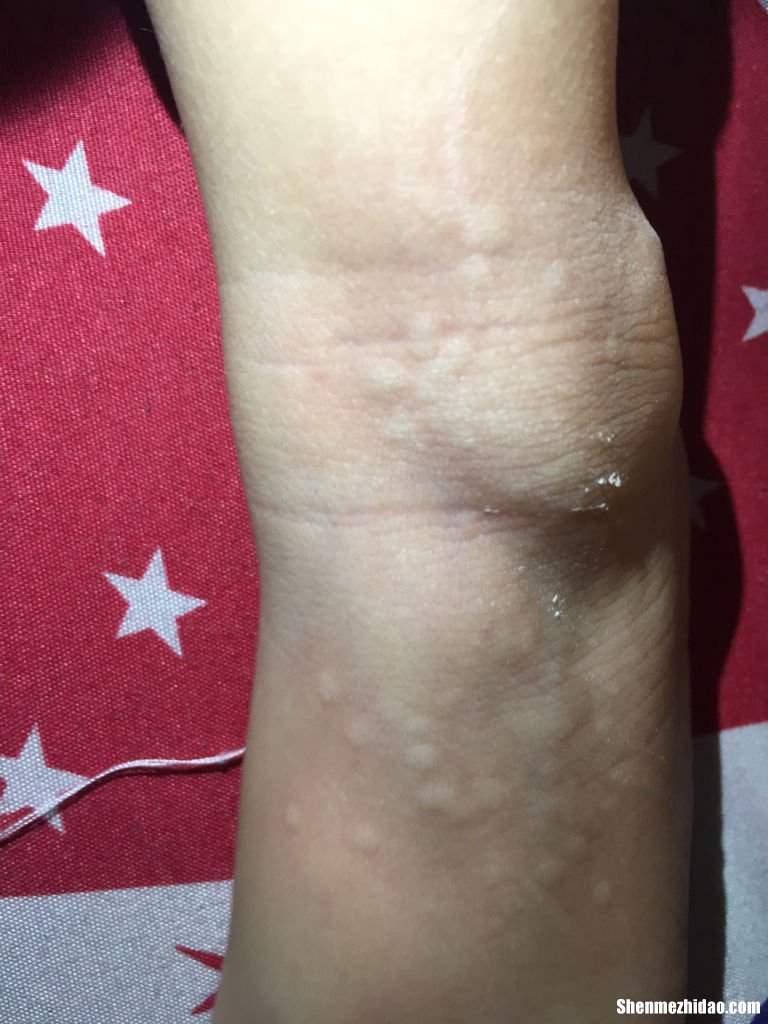 手长的白猴子痒怎么回事 手长的白猴子痒怎么回事啊