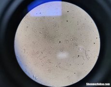 宝宝大便淀粉颗粒怎么 宝宝大便检查淀粉颗粒是怎么回事