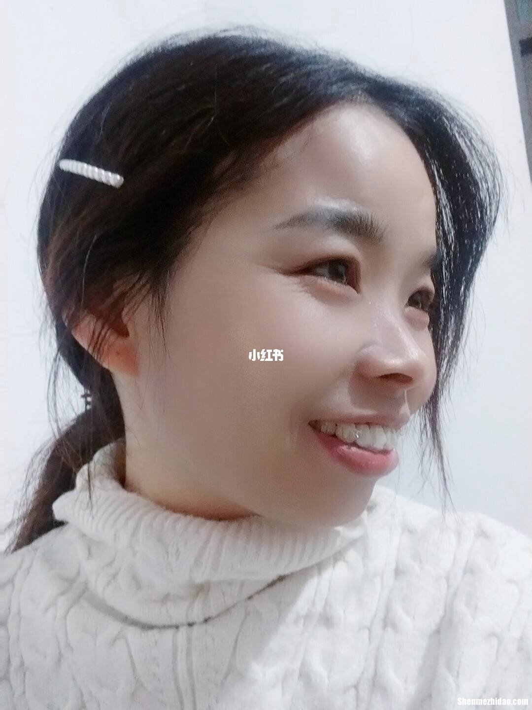 整牙拔牙多久后带牙套 整牙拔牙多久后带牙套较好
