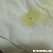 孕晚期尿黄红怎么回事 孕晚期小便发黄红是怎么回事