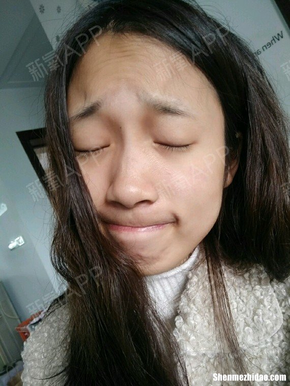女生怎么会有抬头纹 女生有抬头纹怎么去除小妙招