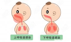 宝宝肺炎一般多久能好 小孩肺炎怎么治疗才能好得快