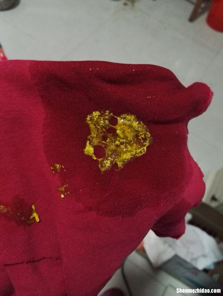 满月的婴儿打紫了怎么办 满月宝宝打完预防针会有什么不良反应