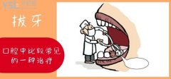 早上拔牙后多久吃饭 早上拔牙后多久吃饭最好