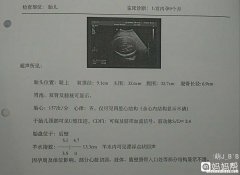 36周孕妇入盆后多久生 36周多已经入盆,什么时候能生