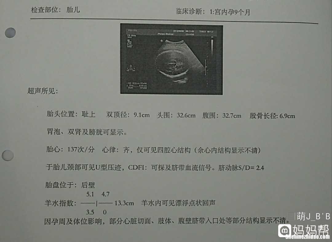 36周孕妇入盆后多久生 36周多已经入盆,什么时候能生