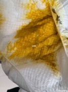 四个月宝宝母乳拉肚子怎么办 四个月宝宝吃母乳拉肚子吃什么好的最快