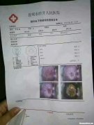 宫颈糜烂多久要复查 宫颈糜烂多久复查一次防癌筛查