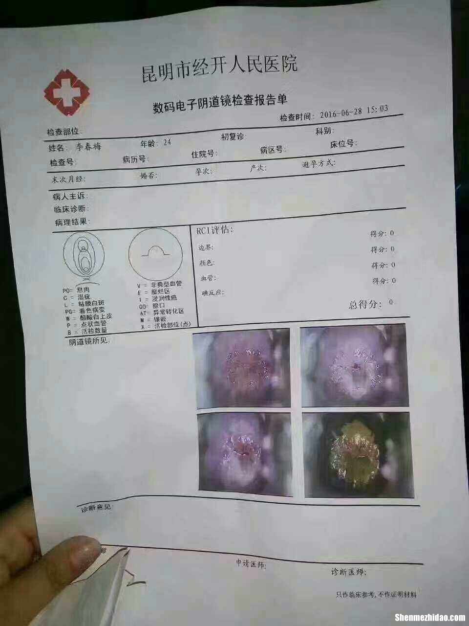 宫颈糜烂多久要复查 宫颈糜烂多久复查一次防癌筛查