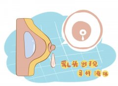 乳房进空气了怎么办 乳房进了空气疼怎么办