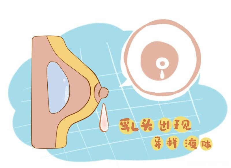乳房进空气了怎么办 乳房进了空气疼怎么办