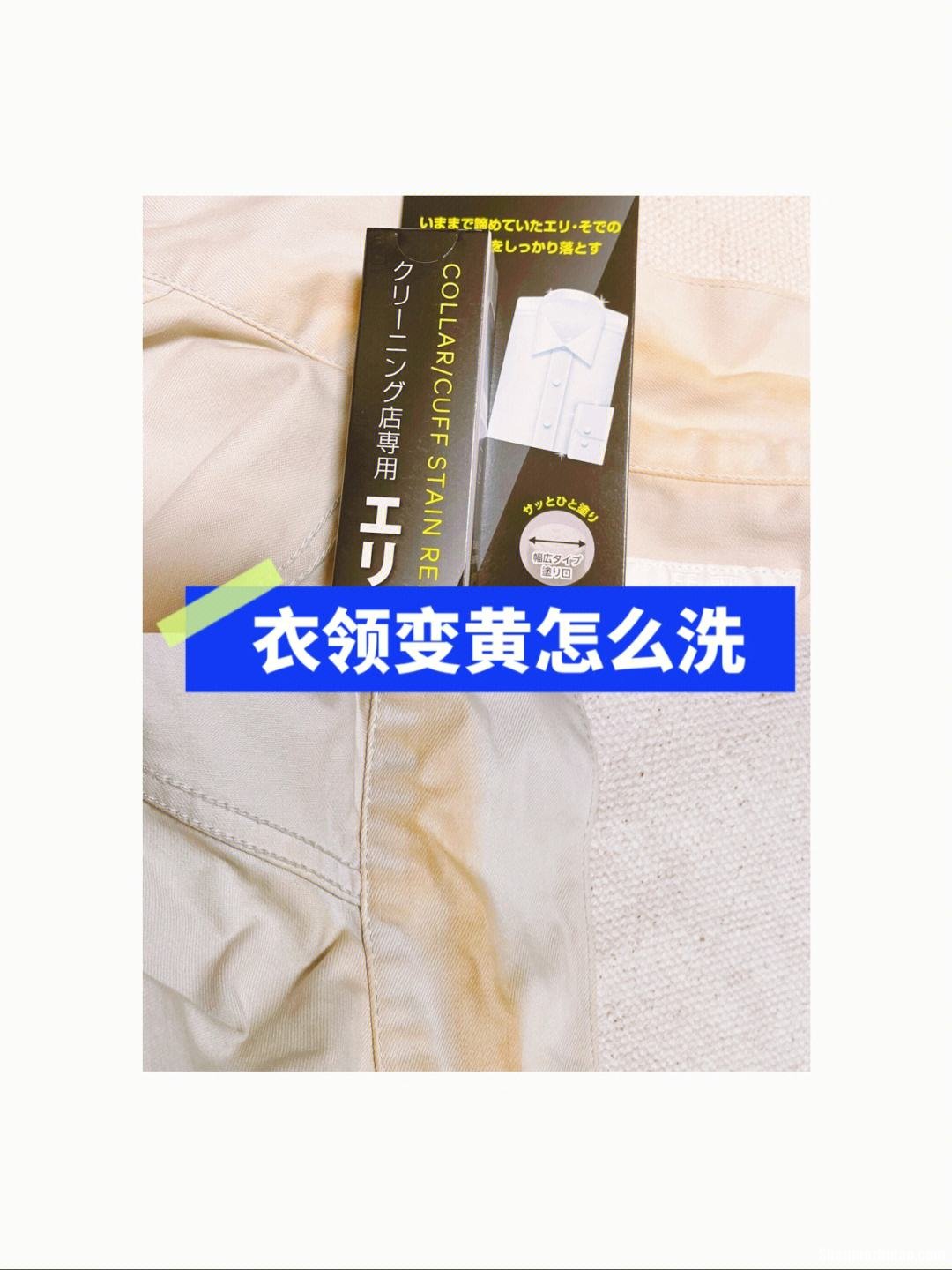领口变黄怎么清洗 领口变黄怎么清洗白