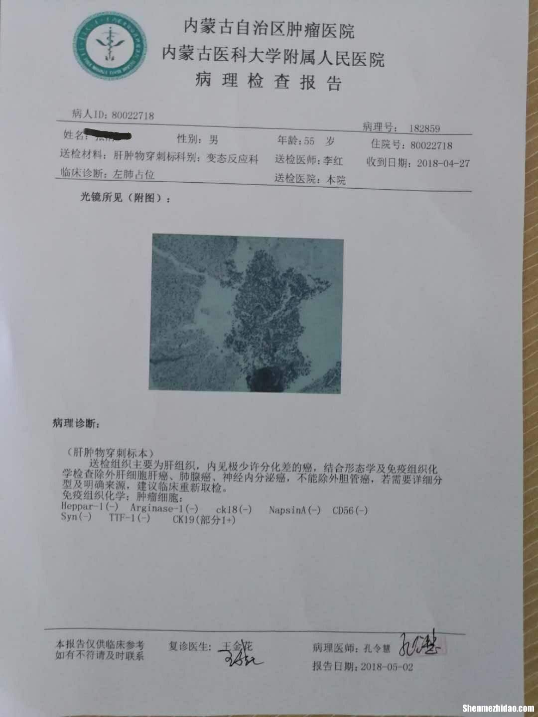 肺癌症中晚期能活多久 肺癌中晚期可以活几年??