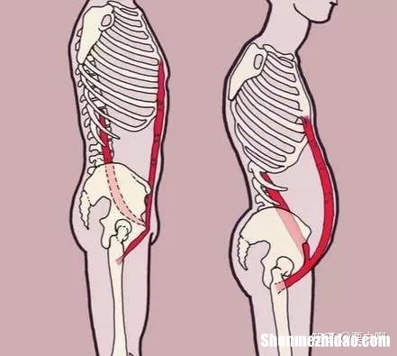 生孩子三个月屁股骨疼痛怎么办 生孩子三个月屁股骨疼痛怎么办呢