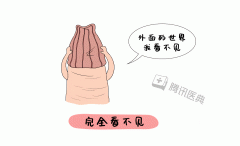 割包皮大概要多久 割包皮大概多久能恢复正常?