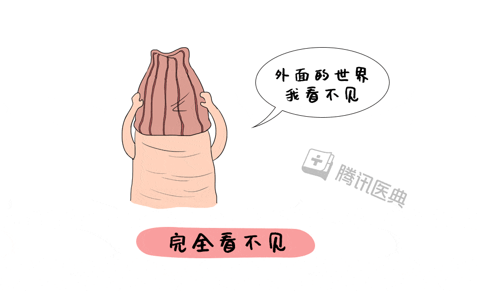 割包皮大概要多久 割包皮大概多久能恢复正常?