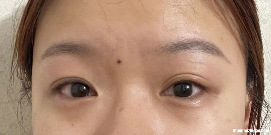 孩子眼睛哭肿多久能好 孩子眼睛哭肿多久能好起来