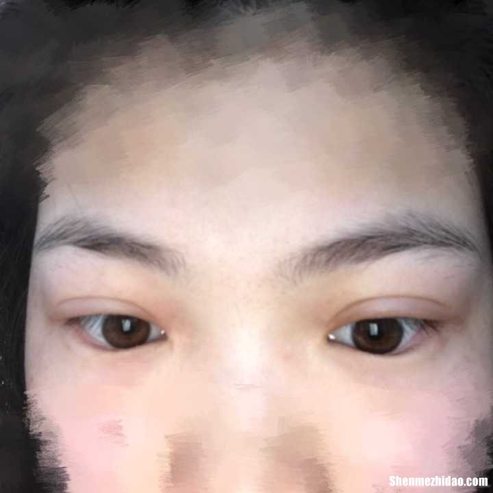 孩子眼睛哭肿多久能好 孩子眼睛哭肿多久能好起来