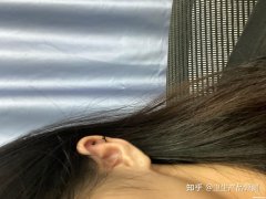 耳洞发炎了怎么治 耳洞发炎了怎么治疗
