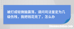 伤残鉴定脑震荡要怎么才可以评 伤残鉴定脑震荡要怎么才可以评上等级