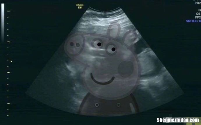 孕妇多久能做b超 孕妇多久能做b超看出男女
