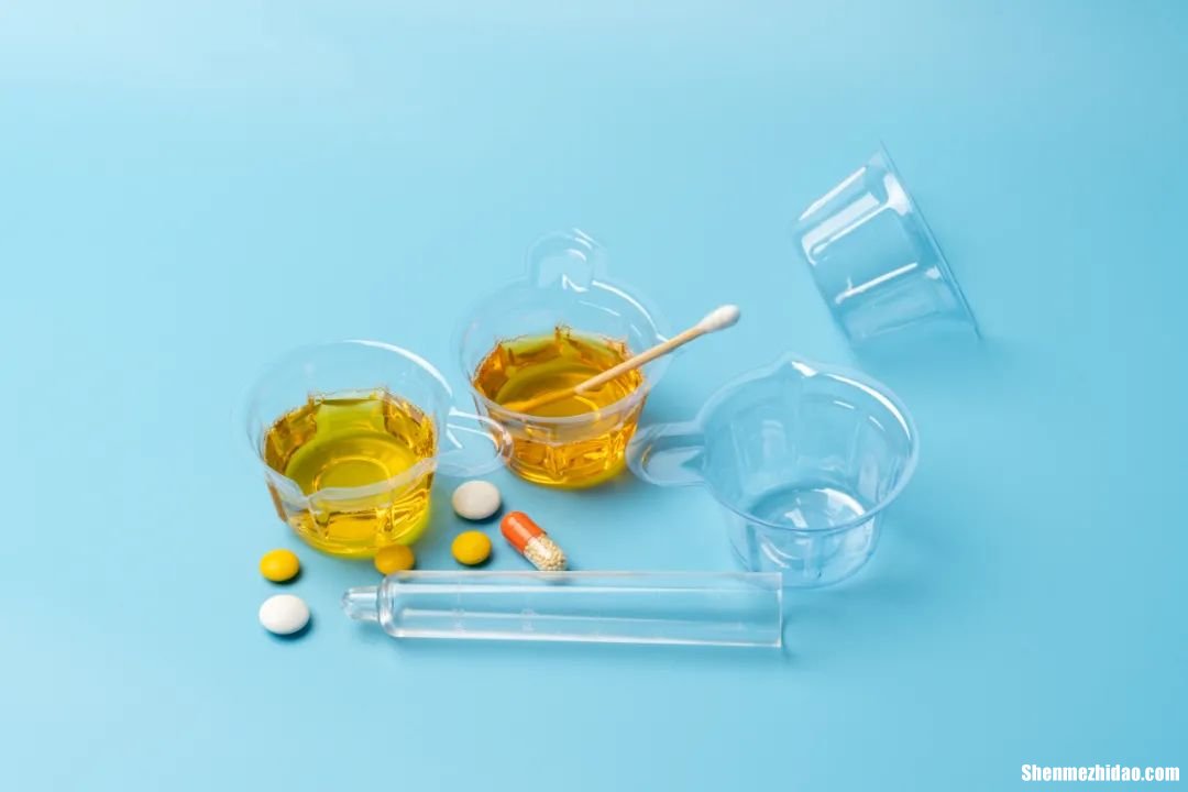 尿胆红素3是怎么引起的 尿胆红素3是怎么引起的原因