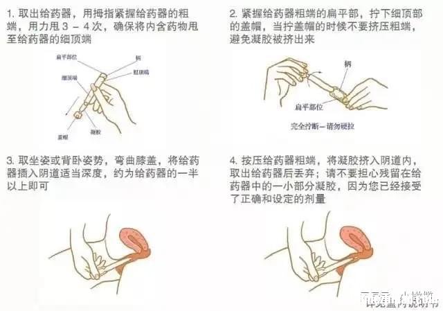 塞的黄体酮多久被吸收 塞的黄体酮多久被吸收完