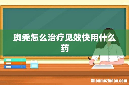 斑秃怎么治疗见效快用什么药