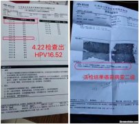hpv高危多久转阴 高危hpv多久可以转阴性