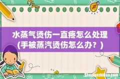 手被蒸汽烫伤怎么办？ 水蒸气烫伤一直疼怎么处理