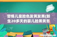 新生20多天的婴儿脸黑黄怎么回事 警惕儿童脸色发黄发黑