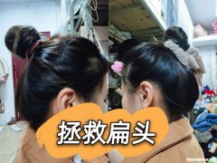 后脑发紧是怎么回事 后脑发紧是什么原因呢