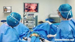 腹腔镜休息多久能上班 腹腔镜休息多少天可以出门