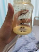 乳头条件很差怎么办 乳头问题有那些,形成原因?如何克服实现成功喂养