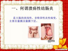 溃疡性结肠炎多久癌变 溃疡性结肠炎时间长了会癌变吗