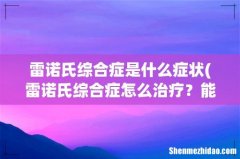 雷诺氏综合症怎么治疗？能治好吗 雷诺氏综合症是什么症状