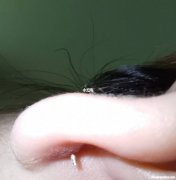打耳洞以后发炎怎么办 打耳洞后发炎有什么症状