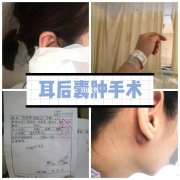 耳硬化症手术后头晕多久能好办 做了耳硬化手术后十二天了为什么耳朵还是闷闷的听不见
